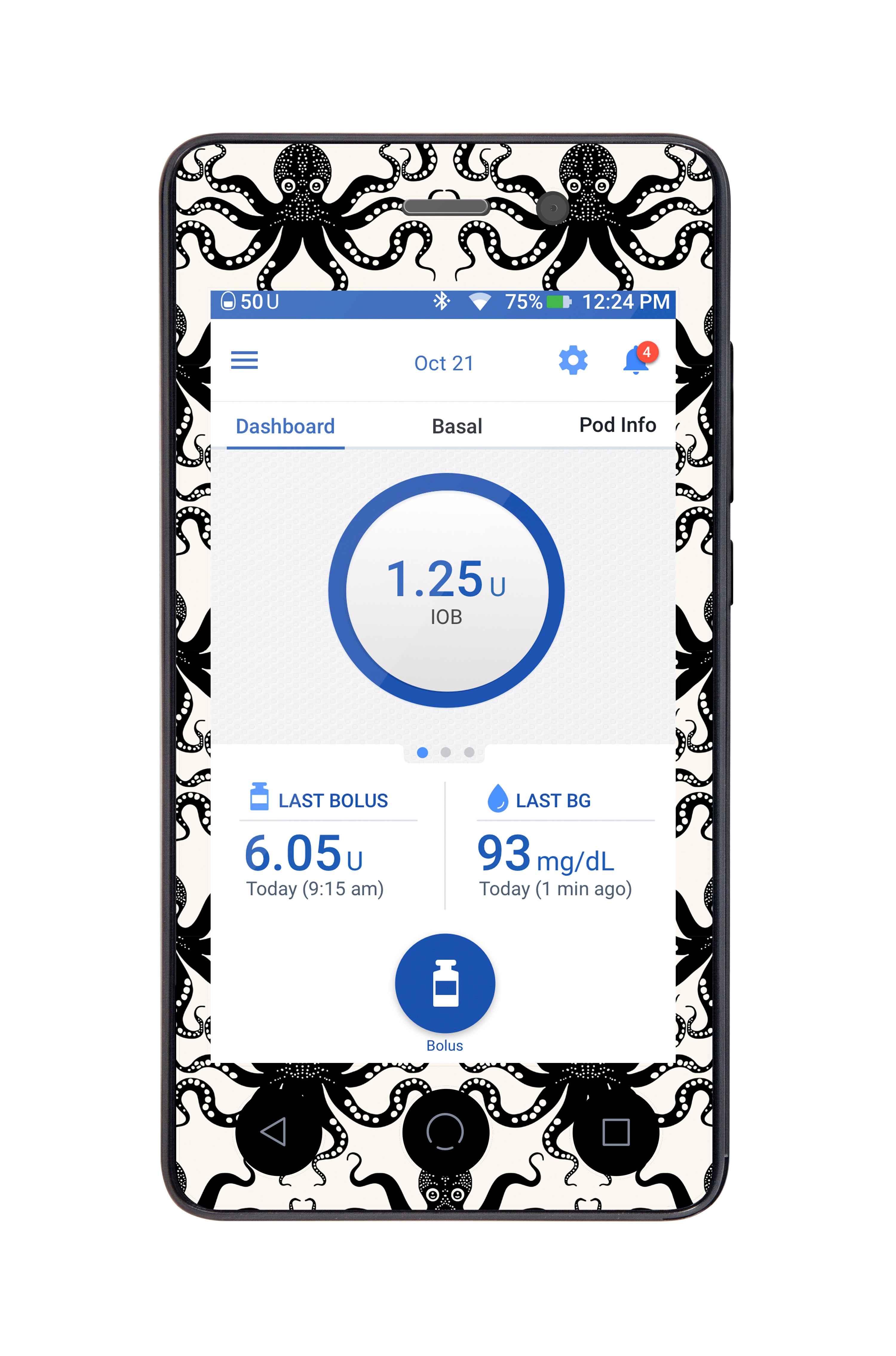 Abstract Octopus for Omnipod DASH™-Pump Peelz