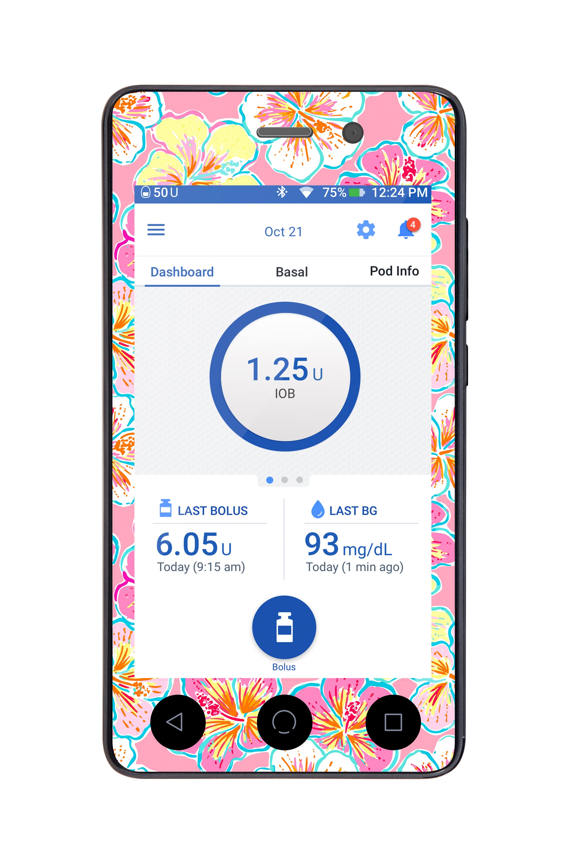 Tropic Crush Sticker for Omnipod DASH® PDM – Pump Peelz