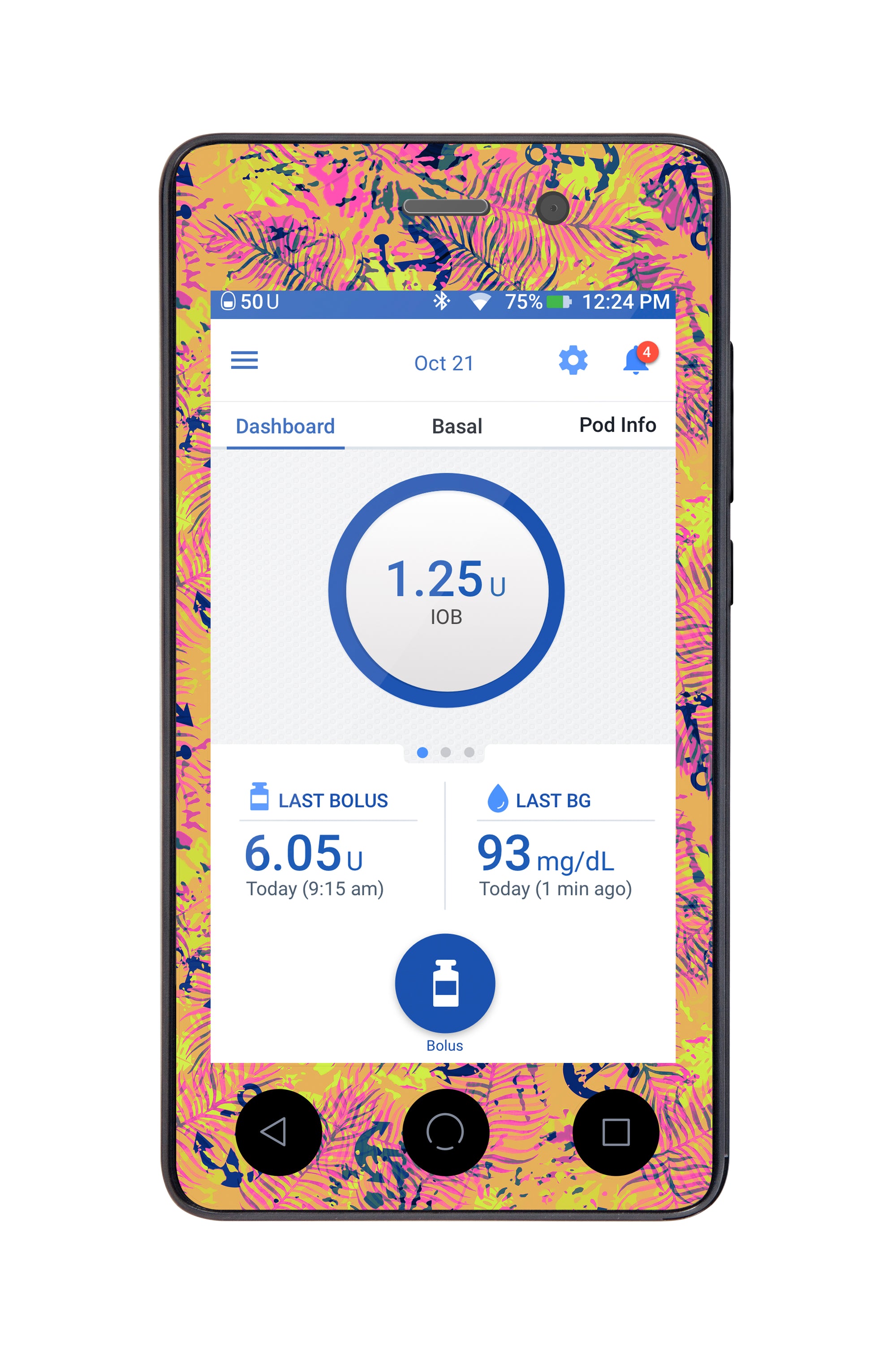 Electric Island  Sticker for Omnipod DASH® PDM – Pump Peelz