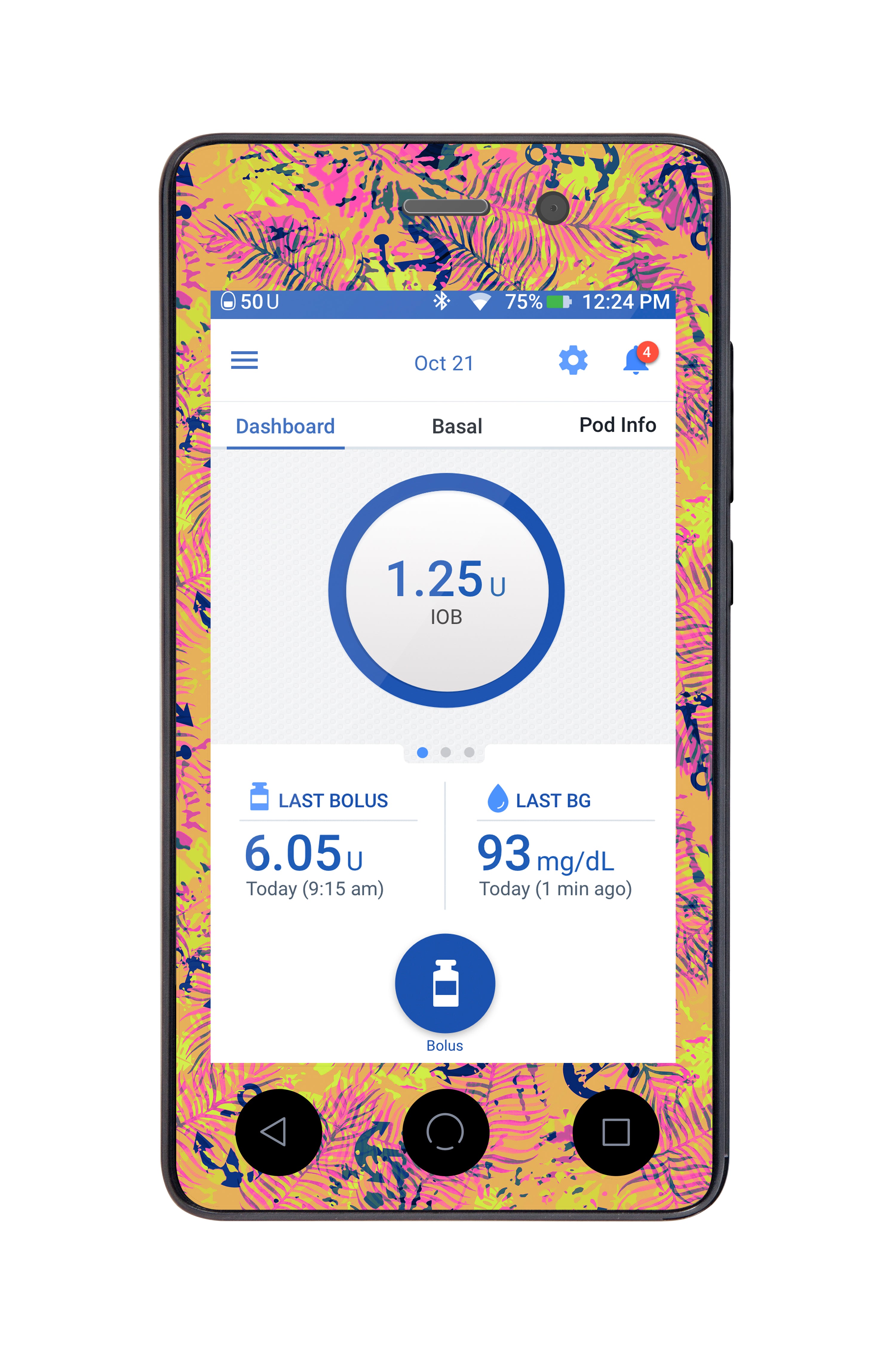 Electric Island  Sticker for Omnipod DASH® PDM – Pump Peelz