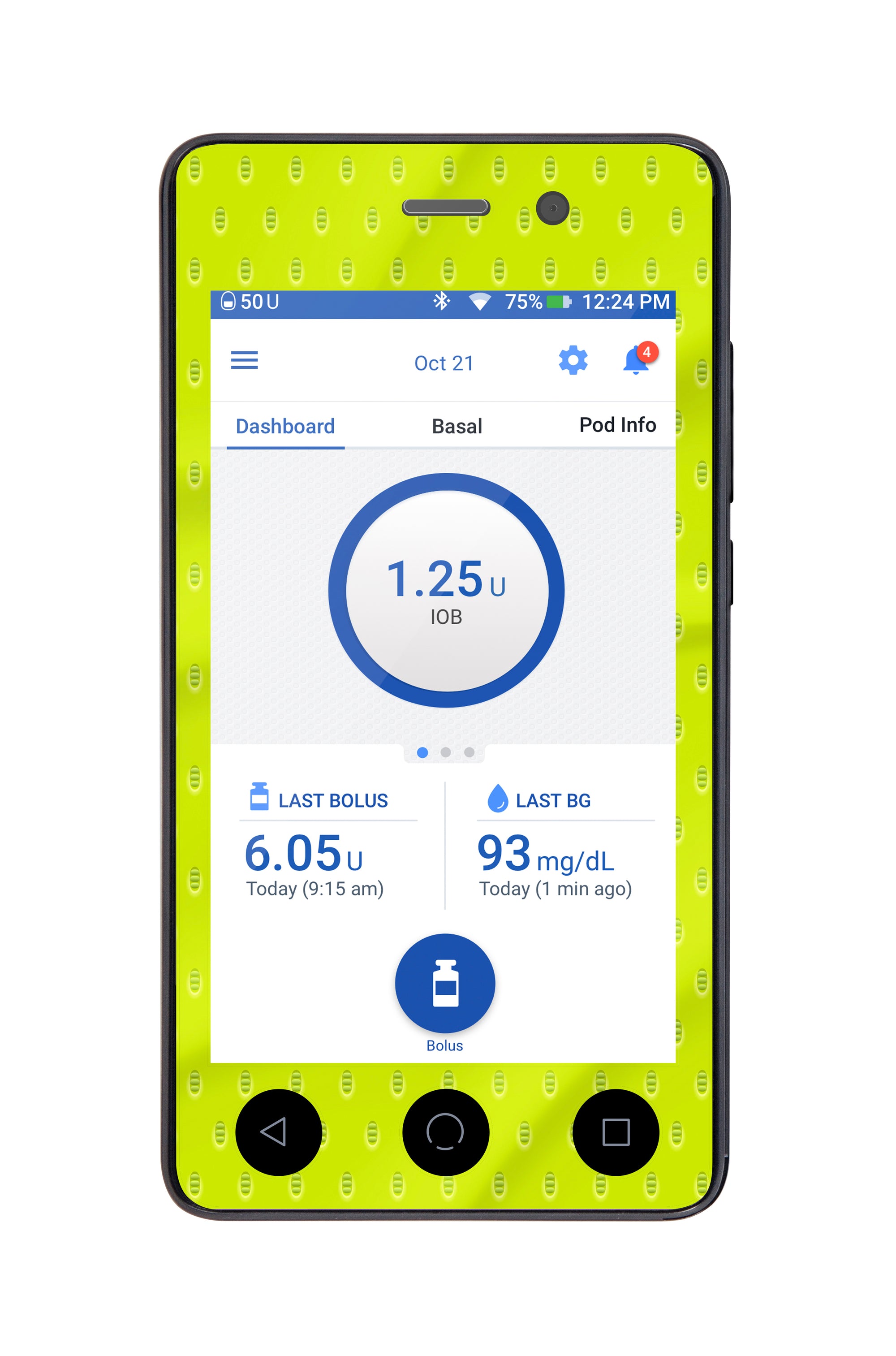 Volt Grip Sticker for Omnipod DASH® PDM – Pump Peelz